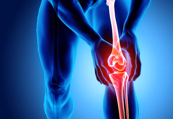 Knee Surgery | Ortho ARC | Dr Blake Fidock