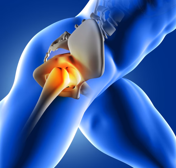 Hip Surgery | Ortho ARC | Dr Blake Fidock